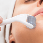Top 5 Myths About Micro Needling Debunked